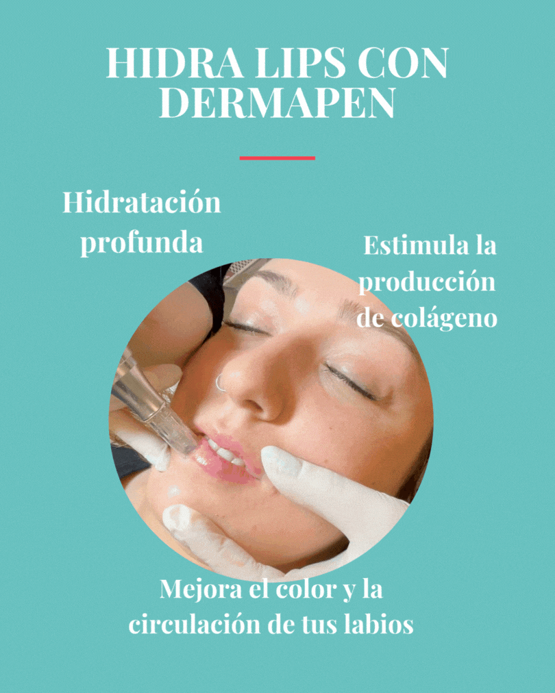 tratamiento facial hidra lips con dermapen